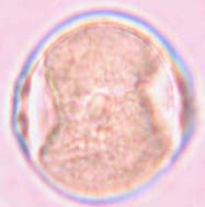 pubescens